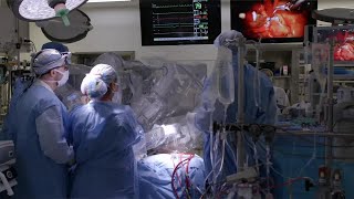 Robotically Assisted Heart Surgery | What to Expect