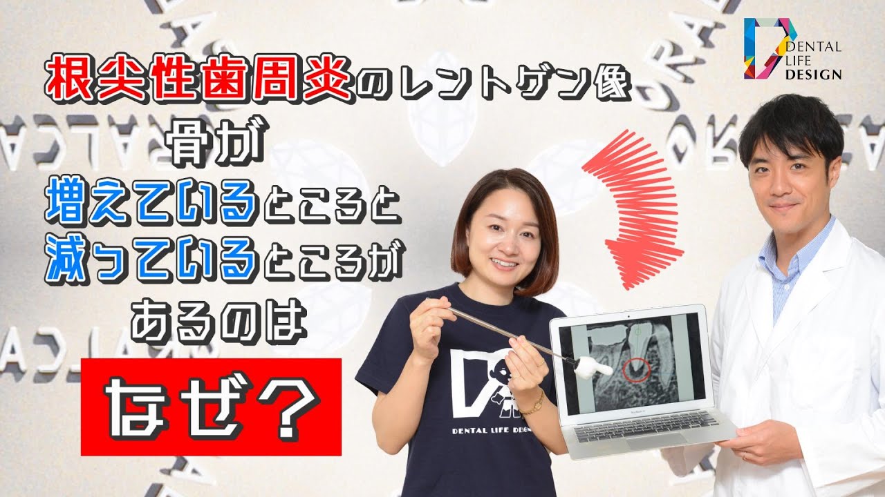 根尖性歯周炎のレントゲン像で、骨が増えているところと減っている