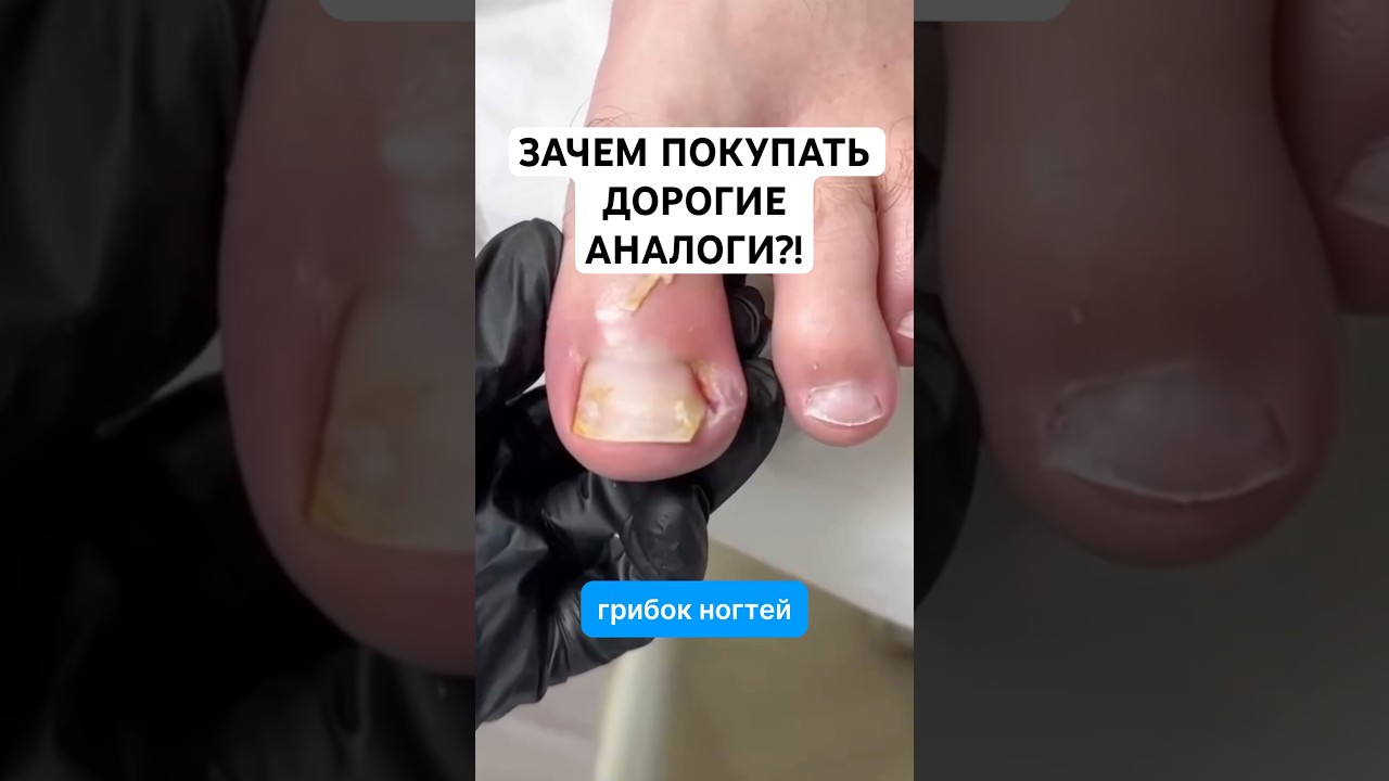 Кажется я знаю все про грибок ногтей!Эффективное средство от грибка ногтей. Артикул - 67774905