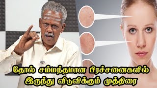 தோல் சம்மந்தமான பிரச்சனைகளில் இருந்து விடுவிக்கும் முத்திரை | ஆனந்த வாழ்வியல்