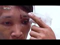 Apat na lalaki, sinugod at inundayan ng saksak ang isang residente sa Caloocan City | Resibo