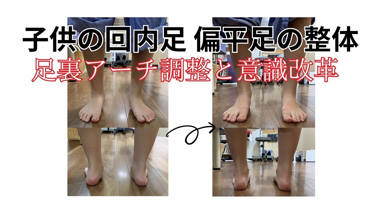 回 内 足 治し 方