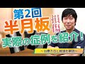 半月板損傷の症例と治療法をご紹介(No.2)なぜ再生治療が有効なのか?!医師が解説