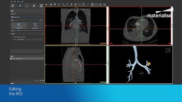 How to Segment Airways | Mimics InPrint Tutorial