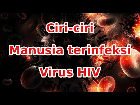Ciri Orang terinfeksi viru HIV
