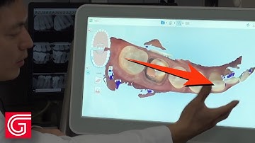 How to Evaluate Your Intraoral Dental Scan