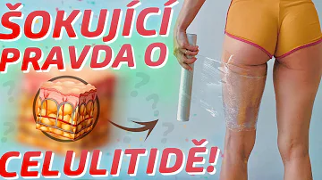 Jaké jsou příčiny vzniku celulitidy?