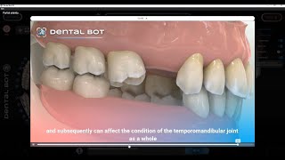 Prosthetic module