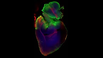 iDISCO+ cleared mouse brain - tdTomato, cFos