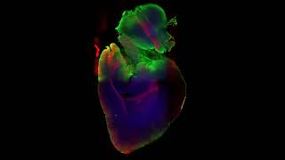 iDISCO+ cleared mouse brain - tdTomato, cFos