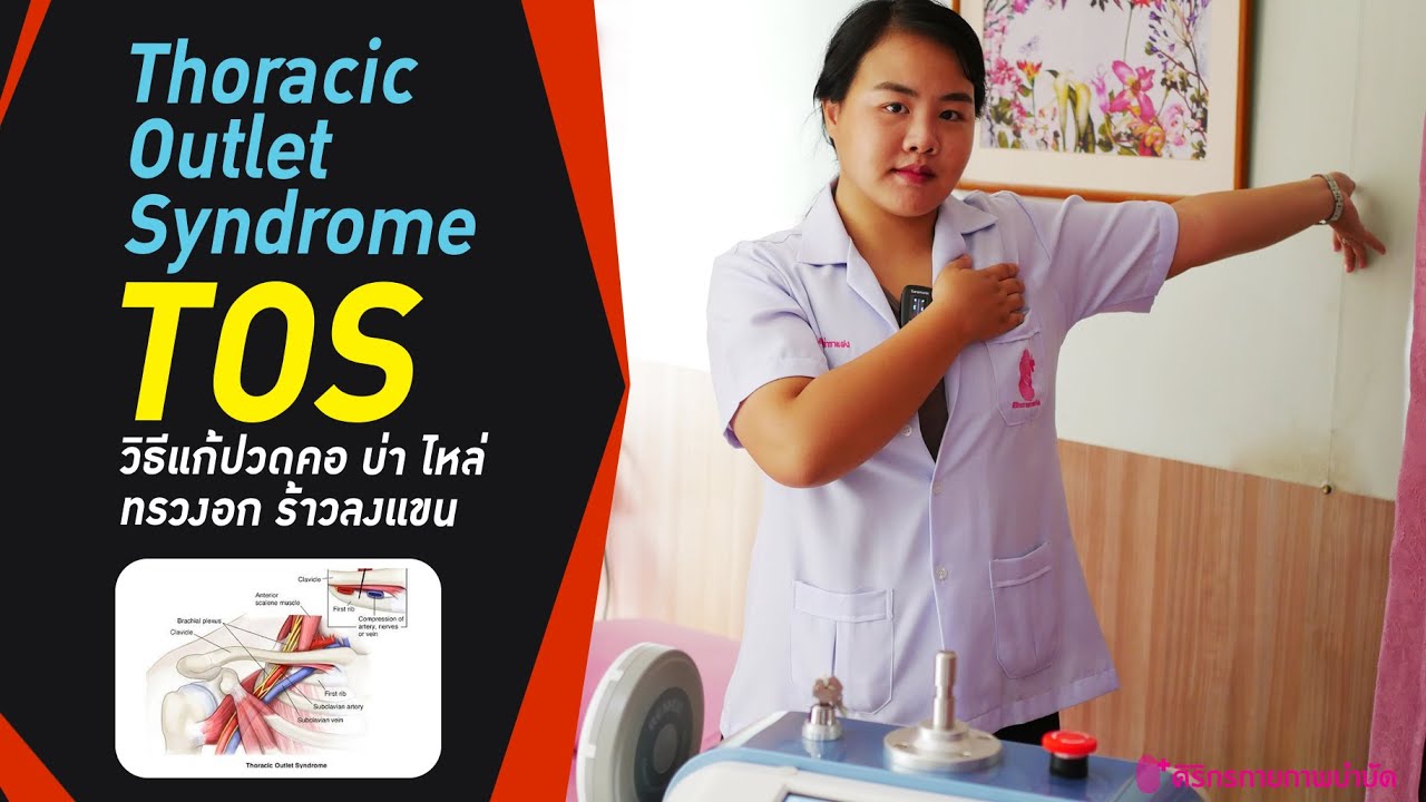 thoracic outlet syndrome (TOS) - YouTube