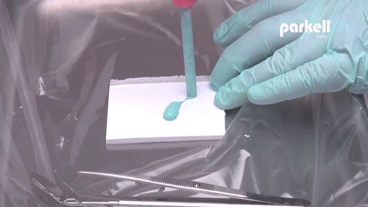 BluMousse® Taking an accurate bite registration using BluMousse