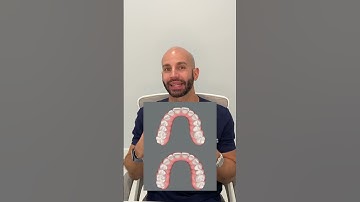Can Invisalign Fix my Bite? (2024)
