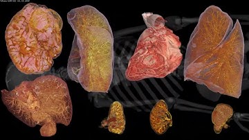 Human Organ Atlas: Seeing inside all our major organs at unprecedented resolution using HiP-CT