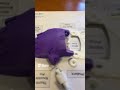 3D Printed Prosthetic Hand: A Peek Inside!