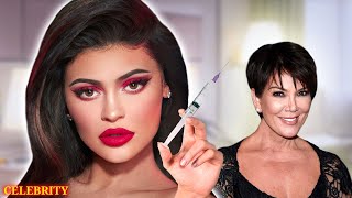 Kylie Jenner reveals the TRUTH behind her plastic surgeries!
