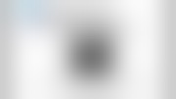 Closed loop small bowel obstruction - adhesive band (Radiopaedia.org) Cases in Radiology