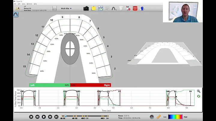 How to Know if You Have a Good, Repeatable T-Scan ...