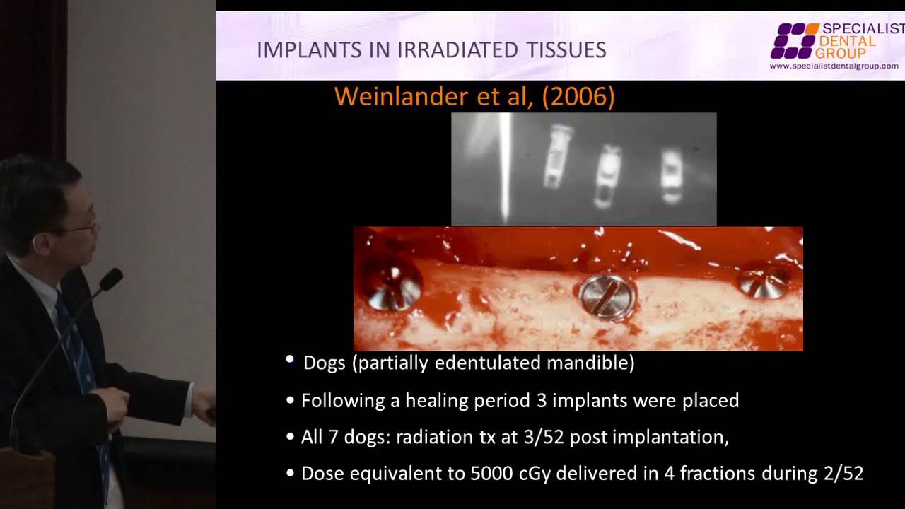 Dental Implants CPG Launch Radiation Therapy and Dental Implant (2 of