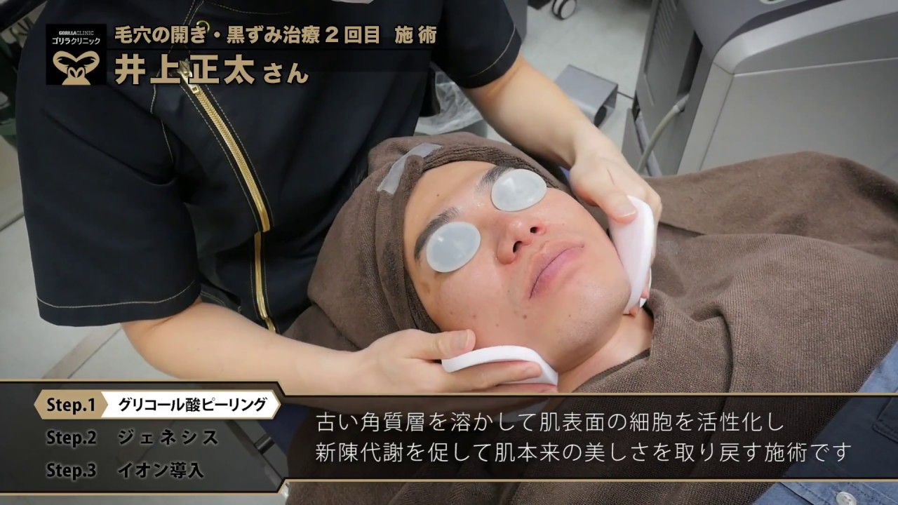 メンズスキンケア 井上正太さん02 男の毛穴の開き 黒ずみ治療 施術の流れ Youtube