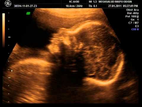 Para que sirve la ecografia doppler obstetrica
