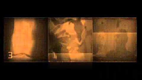 Implant_Rip_that_thing_Misery_Remix.wmv