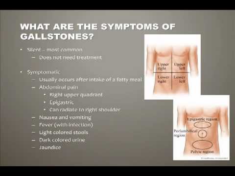 Video: Symptoms of gallbladder disease, as it hurts in women, men