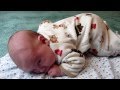 Baby with seizures