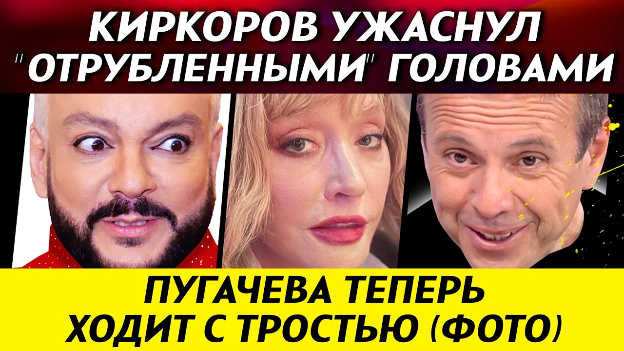 Киркоров шокировал 