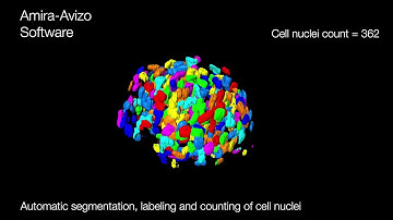 Automated cell nuclei count in 3D spheroid models with Amira Software
