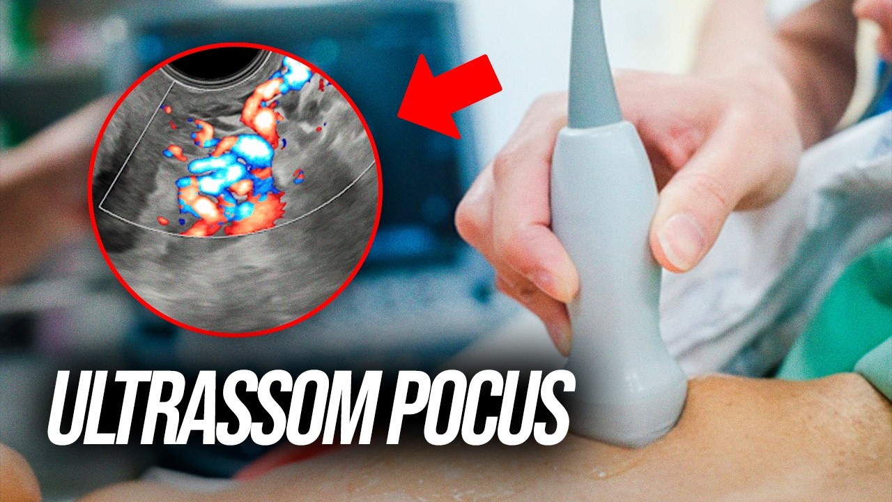 Ultrassom rápido - a verdade sobre o equipamento que vai mudar a medicina