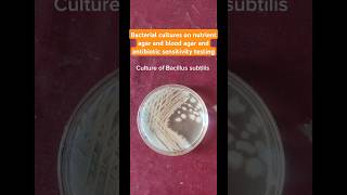 Bacillus Subtilis, Enterococcus Is, Desulfovibrio Cultures And Colonies