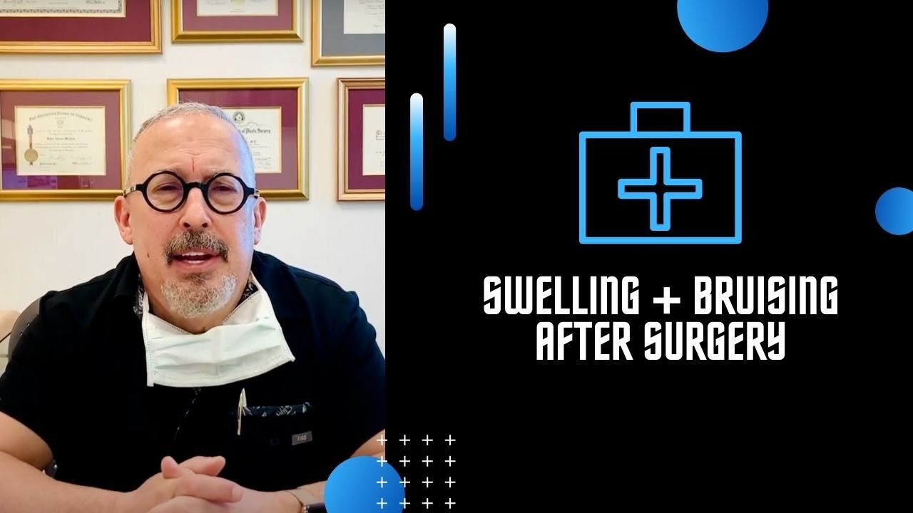 Swelling + Bruising After Surgery - YouTube