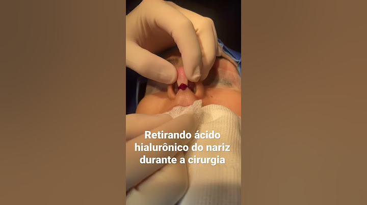 Retirando ácido hialurônico do nariz durante a cirurgia