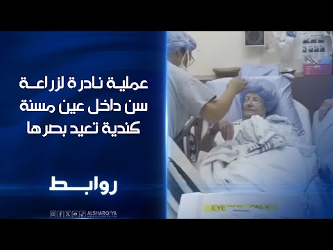 عملية نادرة لزراعة سن داخل عين مسنة كندية تعيد لها بصرها روابط