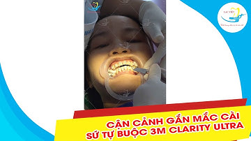 CẬN CẢNH GẮN MẮC CÀI SỨ TỰ BUỘC 3M CLARITY ULTRA