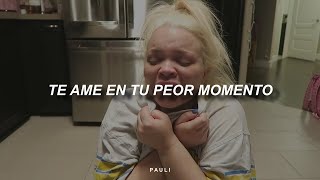 un balonazo en la cara duele menos que esta canción