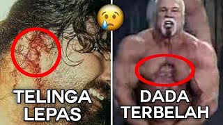 7 Pegulat WWE Yang Tubuhnya Rusak Karena Bertanding