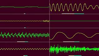 C512W - Homer Let The Bartʼs Out (Oscilloscope View)