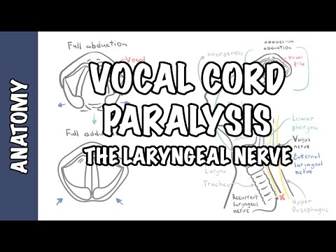 Video: Laryngeal Paralysis