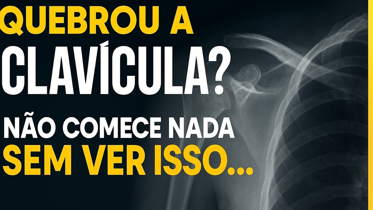 FRATURA DE CLAVÍCULA : NÃO COMECE SUA RECUPERAÇÃO SEM VER ISSO!