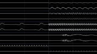 MOTHER 3 - Resolve (oscilloscope view)