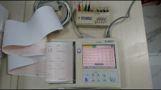 Fukuda Denshi FX-8222 / Test máy đo điện tim Fukuda FX-8222