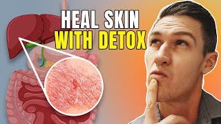 Can a Detox Heal Psoriasis & Inflammation | Is Your Body Ready for a Liver Detox