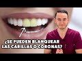 ¿Se pueden blanquear las carillas o coronas que ya tengo?