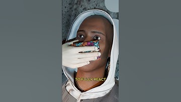 Can Chloroform Make You Unconscious?🙄