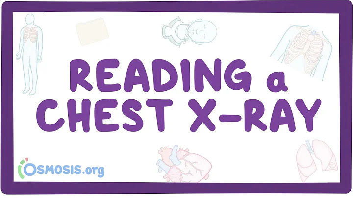 Reading a chest X-ray