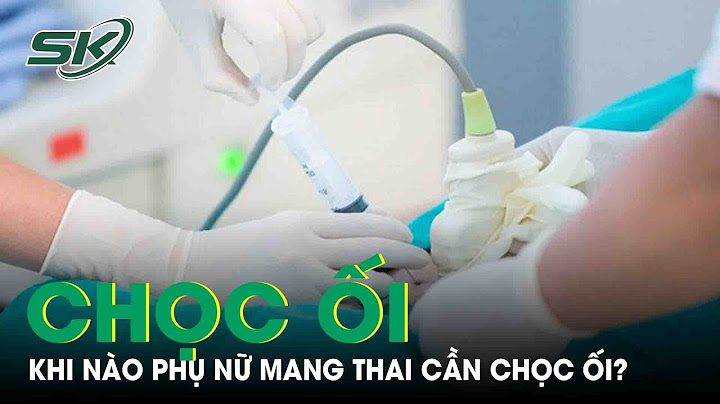 Sàng lọc dị tật thai nhi ở tuần bao nhiêu