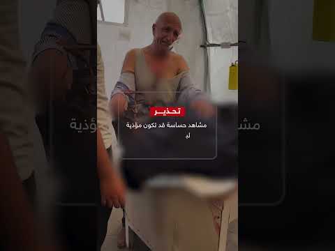 يبكي رفيقة عمره بعدما قتلها الاحتلال