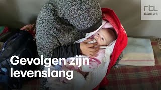 Dit is waarom een hongersnood decennialang zichtbaar blijft